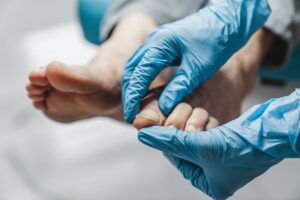 podologia wrastający paznokieć